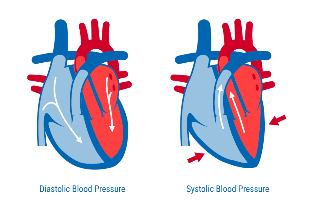 Systolic Vs Diastolic Blood Pressure A D Medical